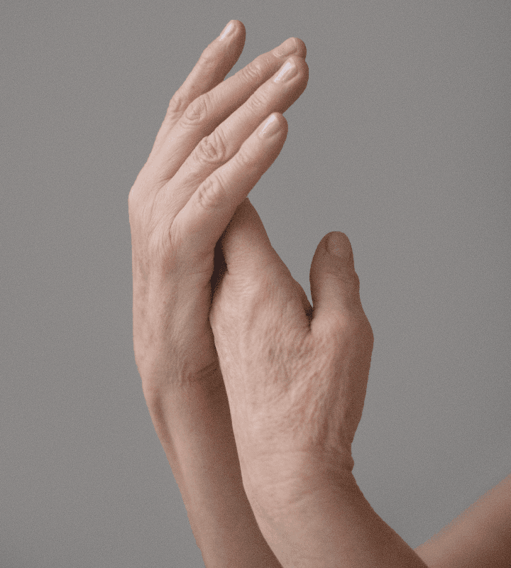 Hand Rejuvenation