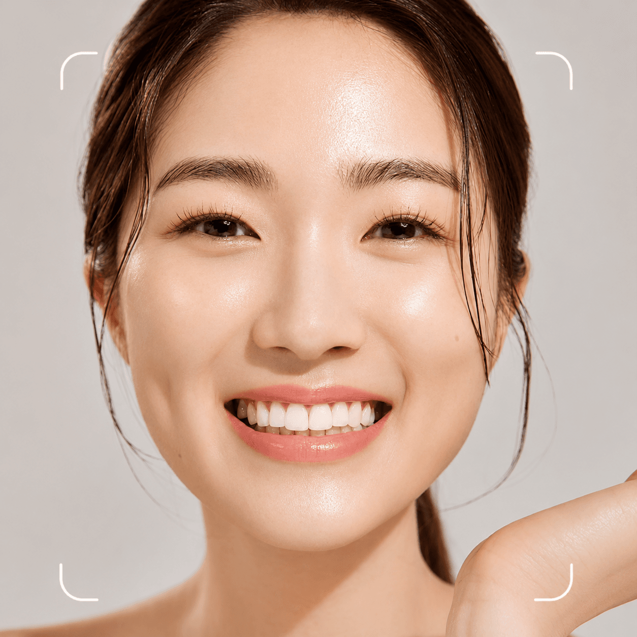 ACNE TREATMENT