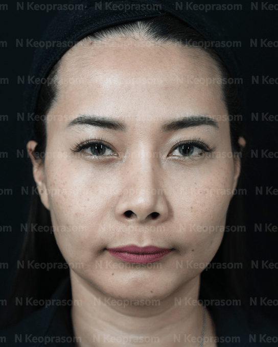 คุณจี before