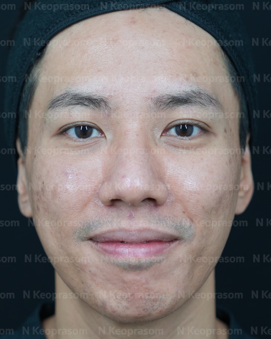 คุณศมน before