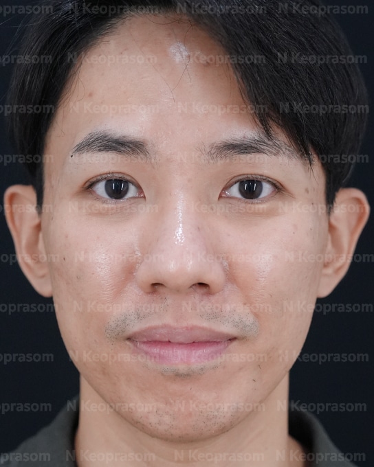 คุณศมน after