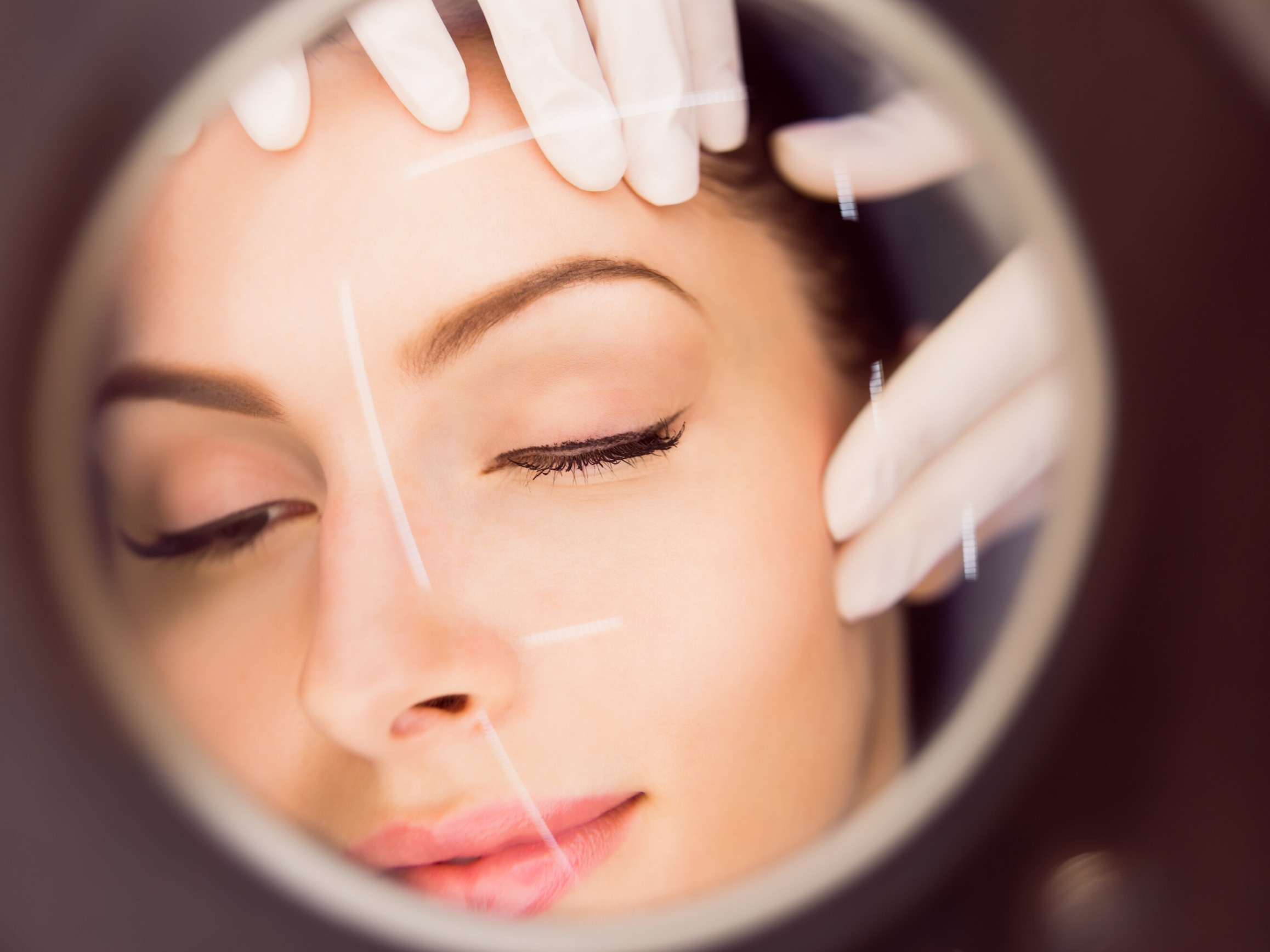 ProDeep Laser treatment