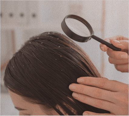 Scalp examination