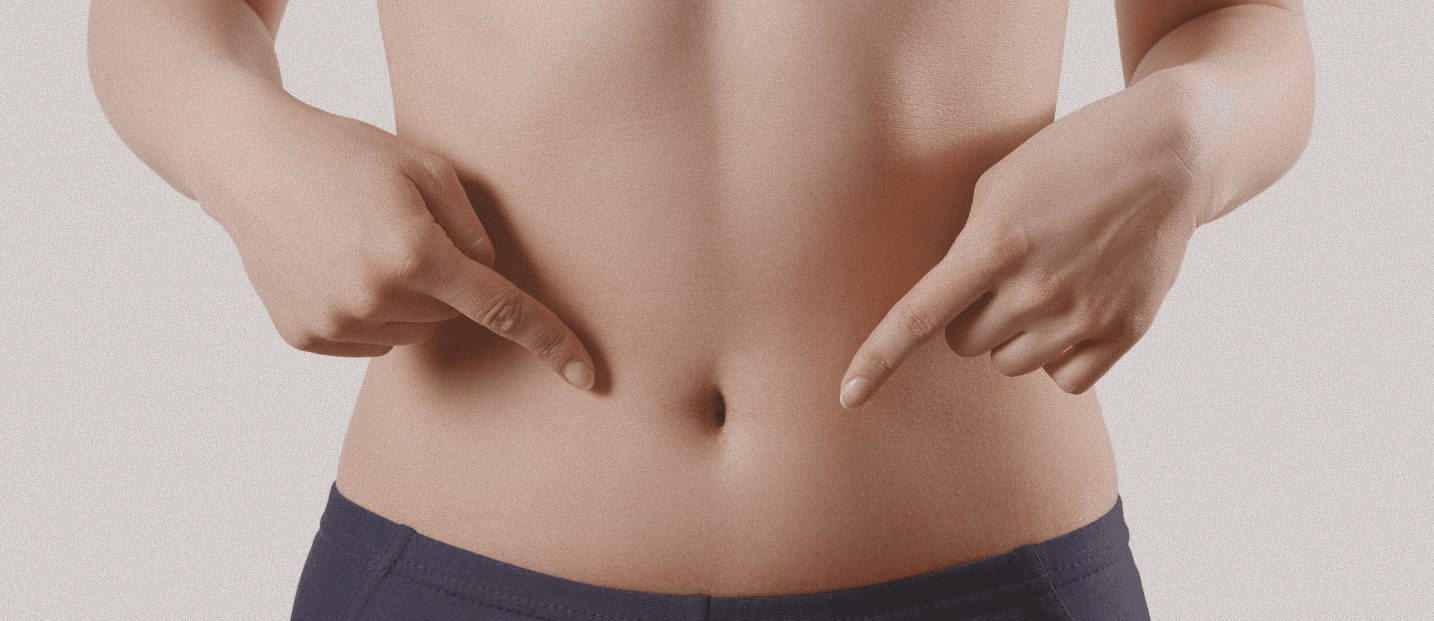 I-SCULPT body contouring