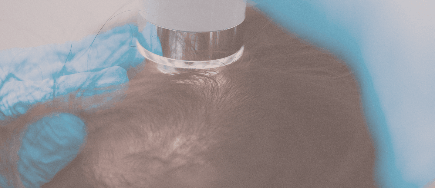 Scalp scan consultation