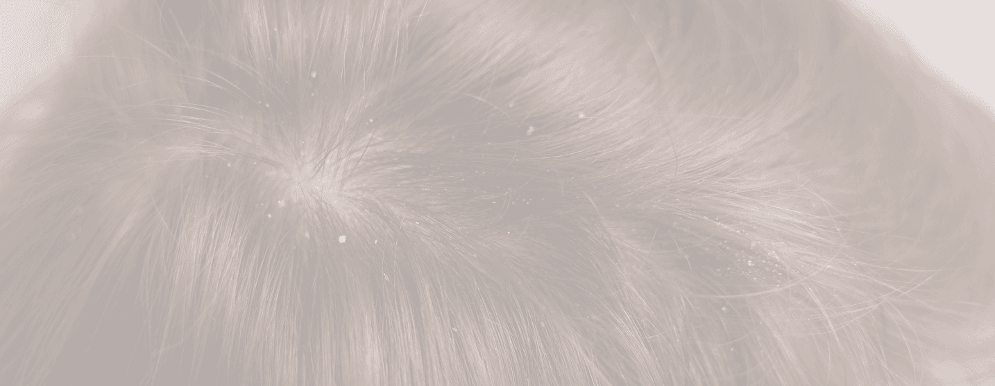 Healthy scalp care