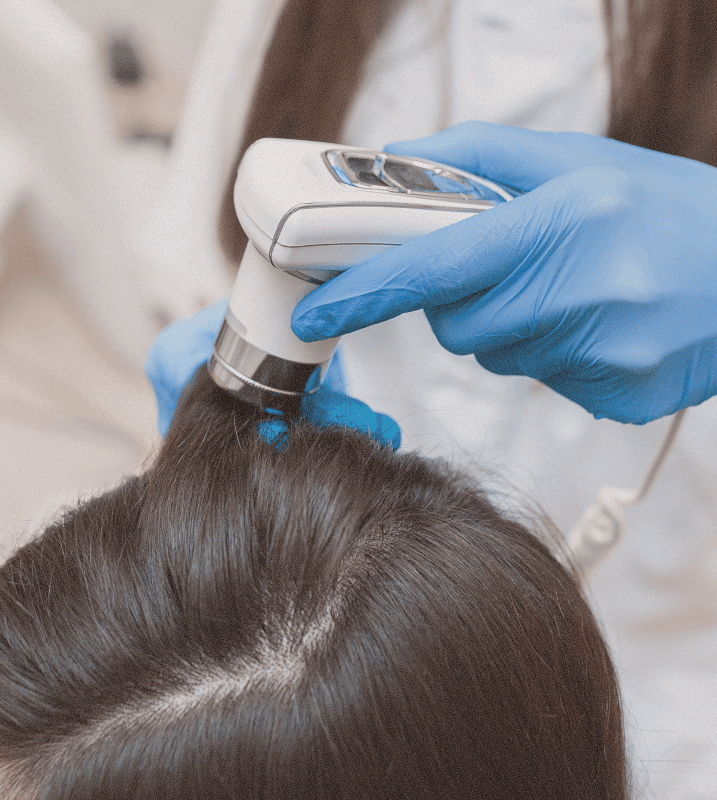 Scalp consultation analysis