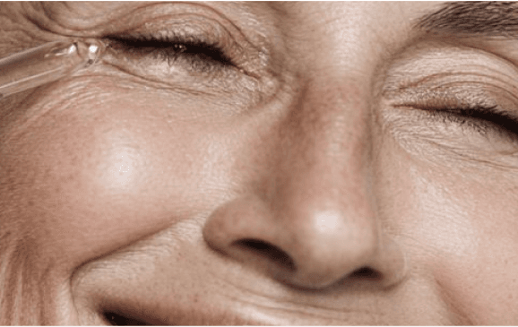 Skin Tightening results after laser lifting