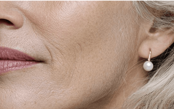 Non-surgical facial lifting and contouring