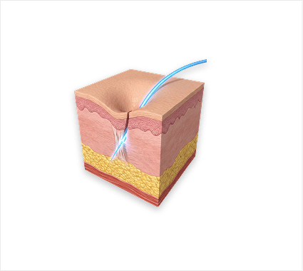 Targeting Adipocytes