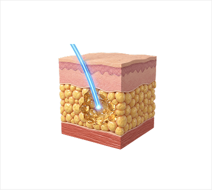 Lipolysis Trigger