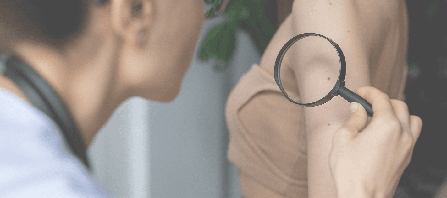 Full body skin cancer screening banner