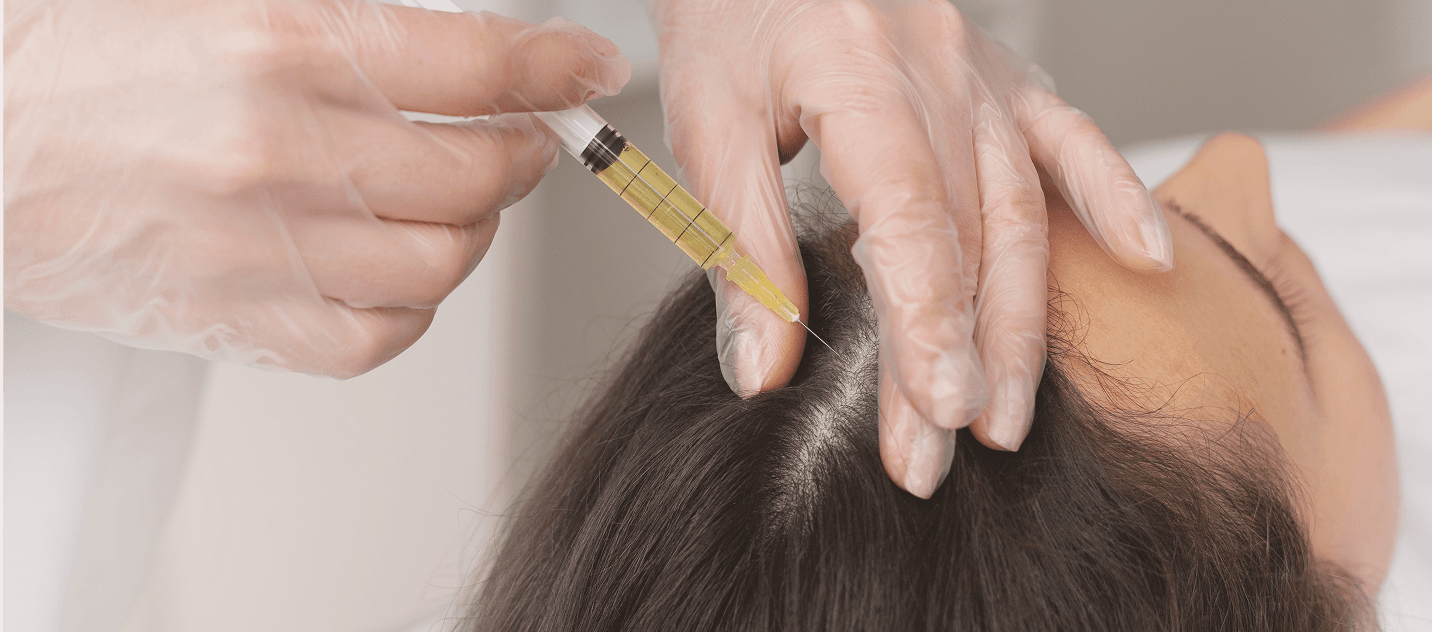 Peptides and Exosome Hair Regrow program banner