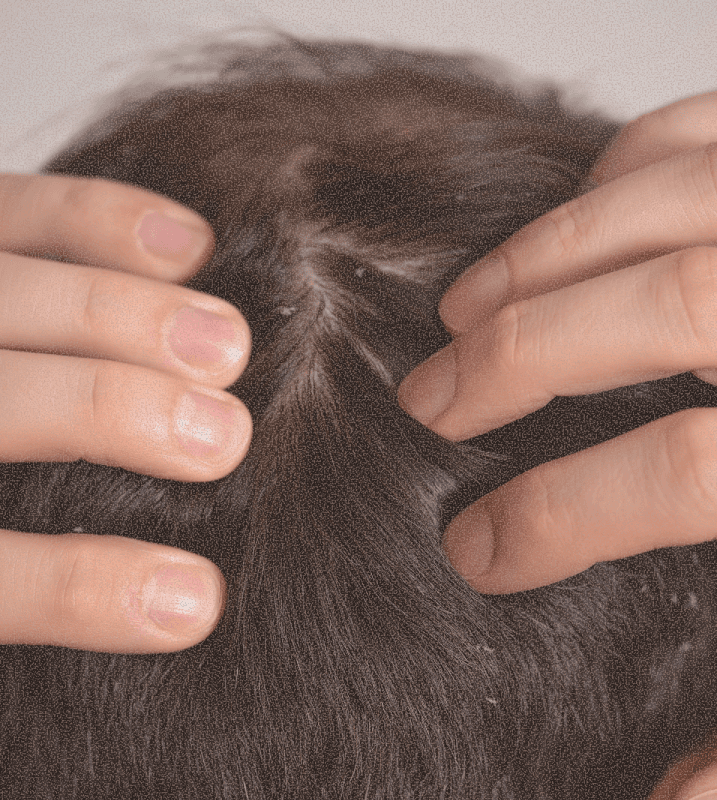 Scalp root assessment