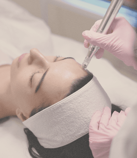 MesoJet facial treatment