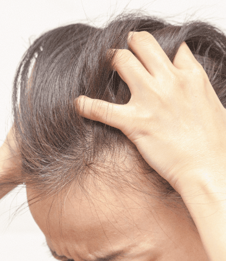 Specialized hair loss care