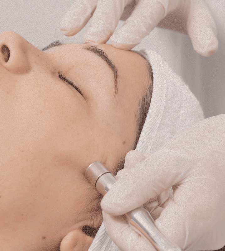 MesoJet skin treatment