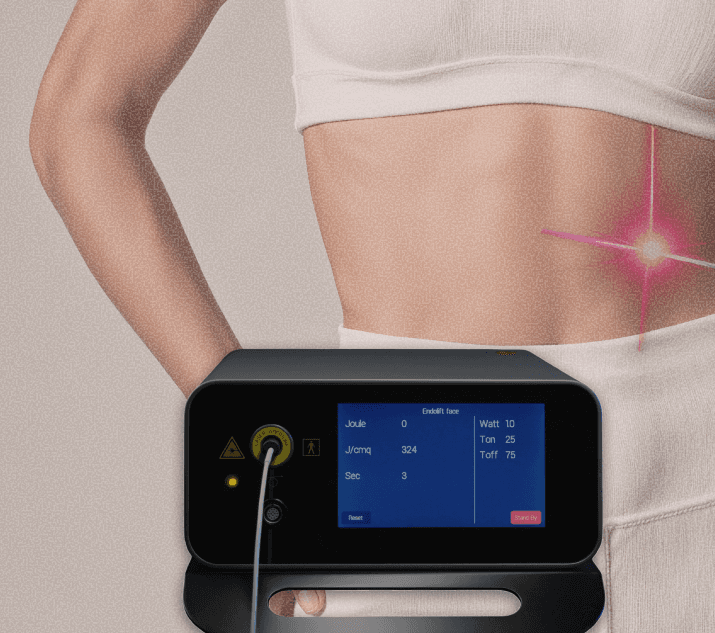 EndoliftX body fat treatment